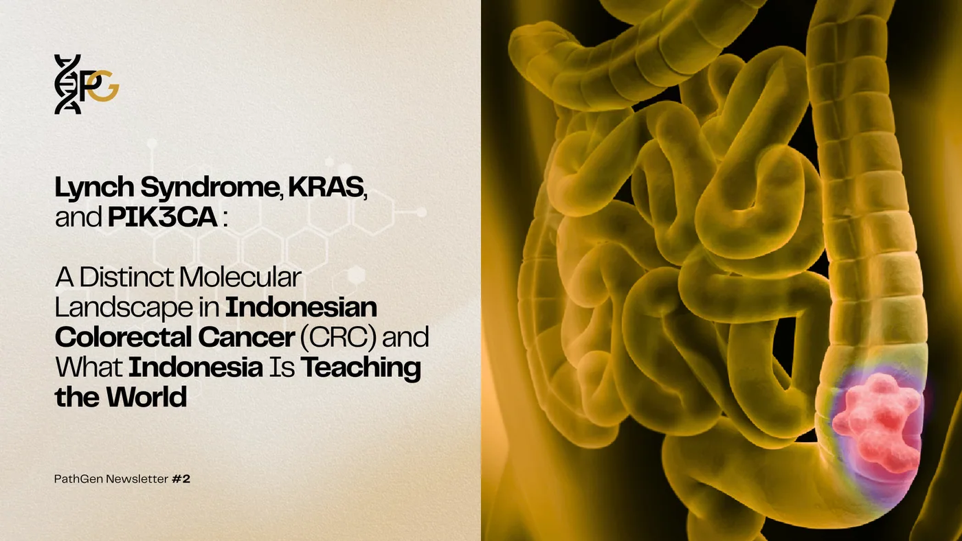 Cover graphic for PathGen Newsletter #2 featuring the title "Lynch Syndrome, KRAS, and PIK3CA: A Distinct Molecular Landscape in Indonesian Colorectal Cancer (CRC) and What Indonesia Is Teaching the World" alongside a 3D medical illustration of a human intestine with a highlighted tumor growth.